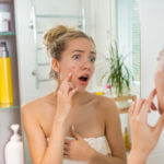 These Are the Best Vitamins and Supplements for Acne